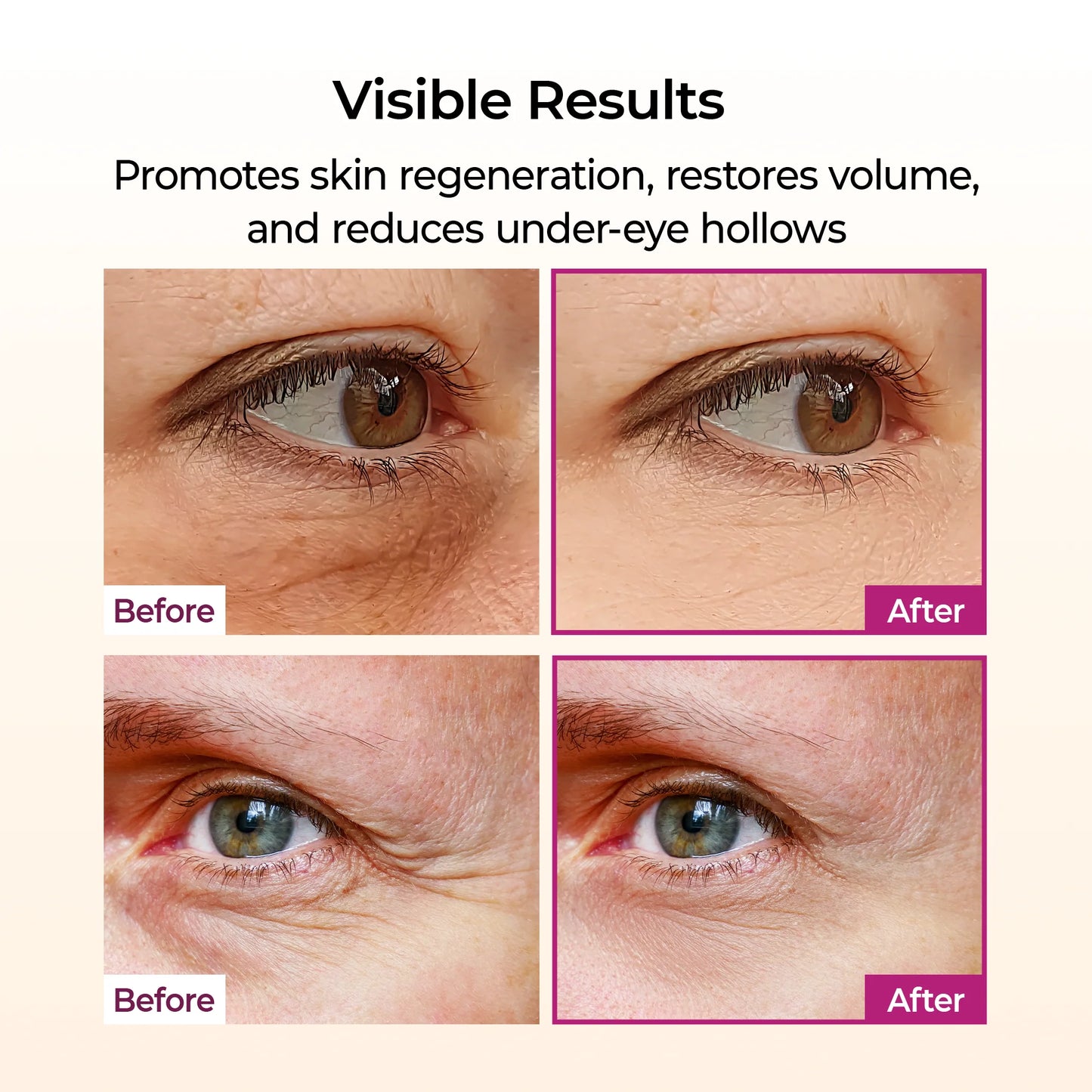 Instant Eye Lift Balm – Reduce Wrinkles & Dark Circles Fast